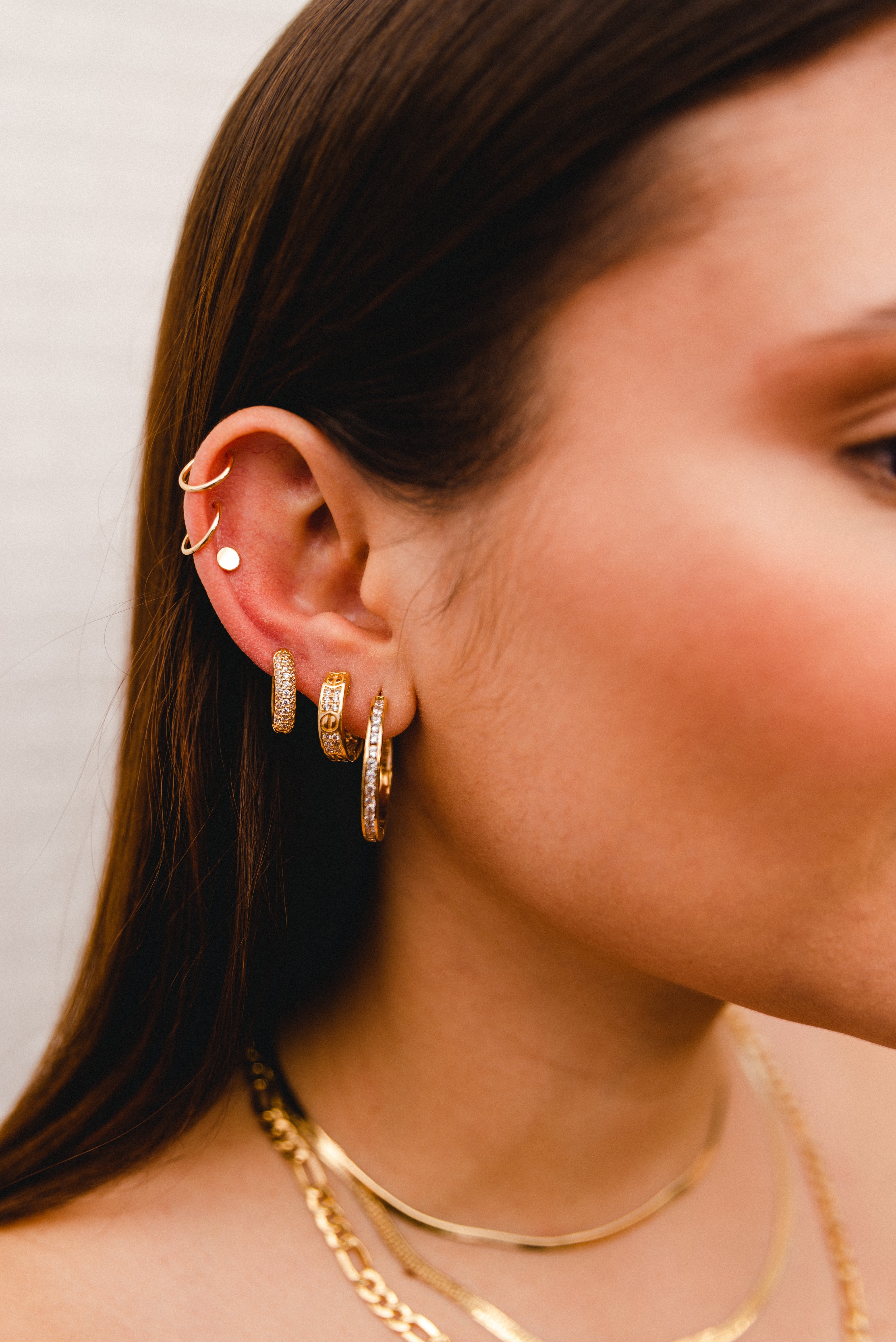 Aretes